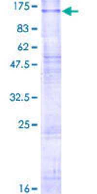 SDS-PAGE: Recombinant Human CLCN6 GST (N-Term) Protein [H00001185-P01]