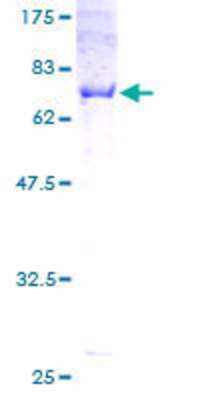 SDS-PAGE: Recombinant Human CNPase GST (N-Term) Protein [H00001267-P01]