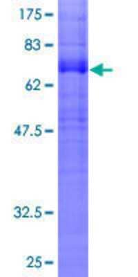 SDS-PAGE: Recombinant Human Cannabinoid R1/CB1/CNR1 GST (N-Term) Protein [H00001268-P01]