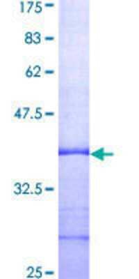 SDS-PAGE: Recombinant Human Collagen VI alpha 1 GST (N-Term) Protein [H00001291-Q01]