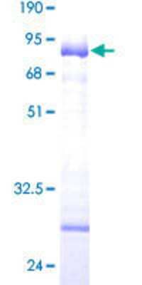 SDS-PAGE: Recombinant Human COL9A1 GST (N-Term) Protein [H00001297-P01]