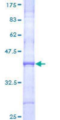 SDS-PAGE: Recombinant Human Collagen XI alpha 2 GST (N-Term) Protein [H00001302-Q01]