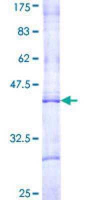 SDS-PAGE: Recombinant Human CPT1B GST (N-Term) Protein [H00001375-Q01]