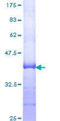 SDS-PAGE: Recombinant Human CPT2 GST (N-Term) Protein [H00001376-Q01]