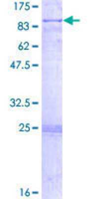 SDS-PAGE: Recombinant Human CRAT GST (N-Term) Protein [H00001384-P01]