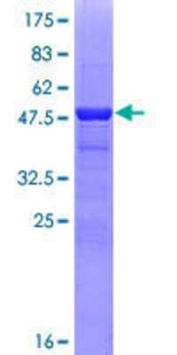 SDS-PAGE: Recombinant Human CRYBA1 GST (N-Term) Protein [H00001411-P01]