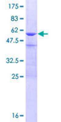 SDS-PAGE: Recombinant Human CRYBB3 GST (N-Term) Protein [H00001417-P01]