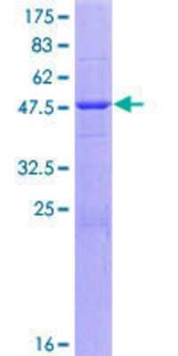 SDS-PAGE: Recombinant Human Casein GST (N-Term) Protein [H00001446-P01]