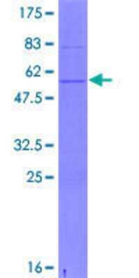 SDS-PAGE: Recombinant Human CSN3 GST (N-Term) Protein [H00001448-P01]