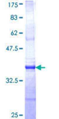 SDS-PAGE: Recombinant Human CTNS GST (N-Term) Protein [H00001497-Q01]