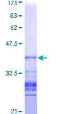 SDS-PAGE: Recombinant Human p120-catenin GST (N-Term) Protein [H00001500-Q01]