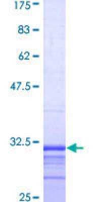 SDS-PAGE: Recombinant Human CYBB/NOX2 GST (N-Term) Protein [H00001536-Q01]