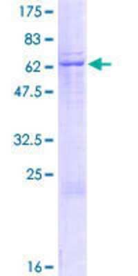 SDS-PAGE: Recombinant Human Cytochrome P450 2B7P1 GST (N-Term) Protein [H00001556-P01]