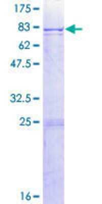 SDS-PAGE: Recombinant Human Cytochrome P450 2C8 GST (N-Term) Protein [H00001558-P01]