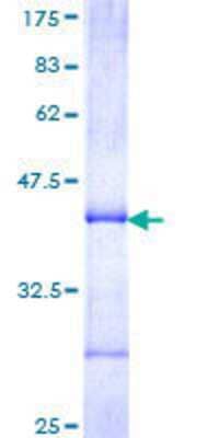 SDS-PAGE: Recombinant Human Cytochrome p450 2J2 GST (N-Term) Protein [H00001573-Q01]