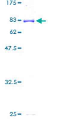 SDS-PAGE: Recombinant Human Cytochrome P450 3A5 GST (N-Term) Protein [H00001577-P01]