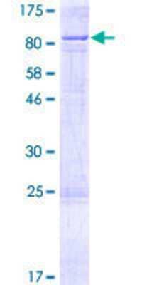 SDS-PAGE: Recombinant Human CYP11B1 GST (N-Term) Protein [H00001584-P01]