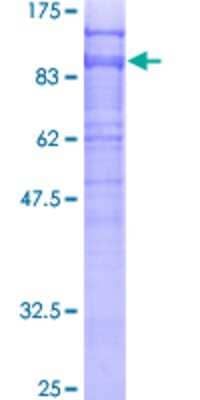 SDS-PAGE: Recombinant Human DAB2 GST (N-Term) Protein [H00001601-P01]