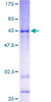 SDS-PAGE: Recombinant Human DBC1 GST (N-Term) Protein [H00001620-P01]