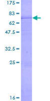 SDS-PAGE: Recombinant Human XPE/DDB2 GST (N-Term) Protein [H00001643-P01]