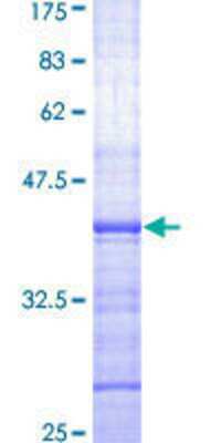 SDS-PAGE: Recombinant Human XPE/DDB2 GST (N-Term) Protein [H00001643-Q01]