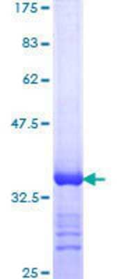 SDS-PAGE: Recombinant Human RNA Helicase A GST (N-Term) Protein [H00001660-Q01]