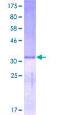 SDS-PAGE: Recombinant Human Defensin alpha 5 GST (N-Term) Protein [H00001670-P01]