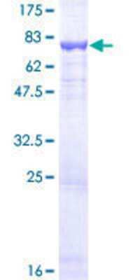 SDS-PAGE: Recombinant Human Dfna5 GST (N-Term) Protein [H00001687-P01]