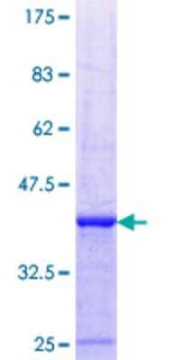 SDS-PAGE: Recombinant Human Dfna5 GST (N-Term) Protein [H00001687-Q01]