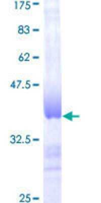 SDS-PAGE: Recombinant Human Deoxyguanosine kinase GST (N-Term) Protein [H00001716-Q01]