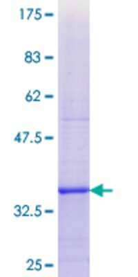 SDS-PAGE: Recombinant Human DIO1 GST (N-Term) Protein [H00001733-Q01]