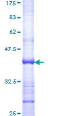 SDS-PAGE: Recombinant Human DIO2 GST (N-Term) Protein [H00001734-Q01]