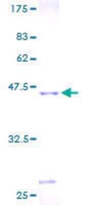 SDS-PAGE: Recombinant Human DIO3 GST (N-Term) Protein [H00001735-P01]