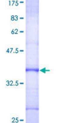 SDS-PAGE: Recombinant Human DKC1 GST (N-Term) Protein [H00001736-Q01]