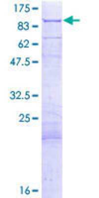 SDS-PAGE: Recombinant Human Pyruvate Dehydrogenase E2 GST (N-Term) Protein [H00001737-P01]