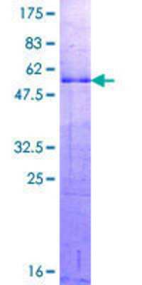 SDS-PAGE: Recombinant Human Dlx1 GST (N-Term) Protein [H00001745-P01]