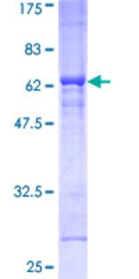 SDS-PAGE: Recombinant Human dystrophia myotonica containing WD repeat motif GST (N-Term) Protein [H00001762-P01]