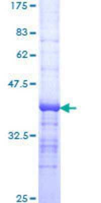 SDS-PAGE: Recombinant Human DNase II GST (N-Term) Protein [H00001777-Q01]