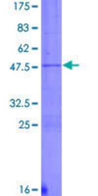 SDS-PAGE: Recombinant Human DYNC1H1 GST (N-Term) Protein [H00001778-P01]