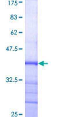 SDS-PAGE: Recombinant Human DNMT3A GST (N-Term) Protein [H00001788-Q01]