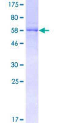 SDS-PAGE: Recombinant Human DOCK2 GST (N-Term) Protein [H00001794-P01]