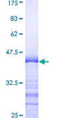 SDS-PAGE: Recombinant Human ATN1 GST (N-Term) Protein [H00001822-Q01]