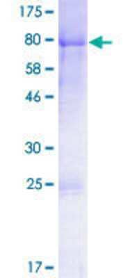 SDS-PAGE: Recombinant Human Dishevelled-1 GST (N-Term) Protein [H00001855-P01]