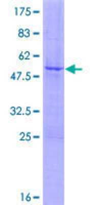 SDS-PAGE: Recombinant Human Endothelin-1 GST (N-Term) Protein [H00001906-P01]