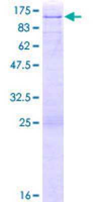 SDS-PAGE: Recombinant Human E74 like factor 1 GST (N-Term) Protein [H00001997-P01]