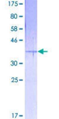 SDS-PAGE: Recombinant Human EMP3 GST (N-Term) Protein [H00002014-P01]