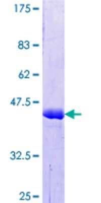 SDS-PAGE: Recombinant Human Cortactin GST (N-Term) Protein [H00002017-Q01]