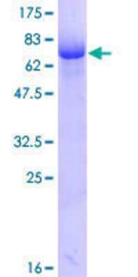 SDS-PAGE: Recombinant Human Dematin GST (N-Term) Protein [H00002039-P01]