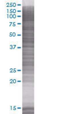 Other: Erythropoietin R 293T Cell Transient Overexpression Lysate [H00002057-T01]