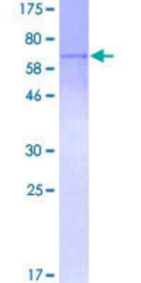 SDS-PAGE: Recombinant Human XPD GST (N-Term) Protein [H00002068-P01]